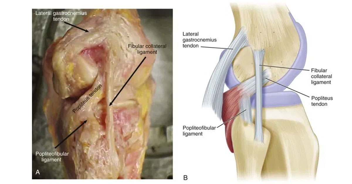  The Posterolateral Corner (PLC) of the knee is an inherently important component in both knee function and stability.