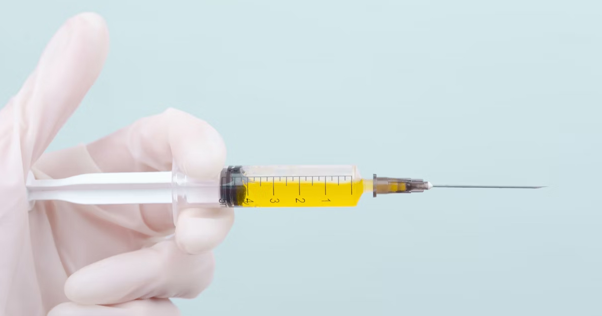 A comprehensive overview of PRP therapy, its mechanism of action, and the current evidence supporting its use, relevant to clinicians in North Ryde, Macquarie Park, and beyond.