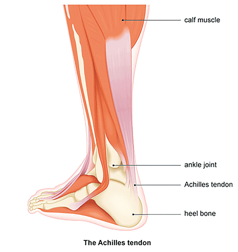 Achilles Tendon