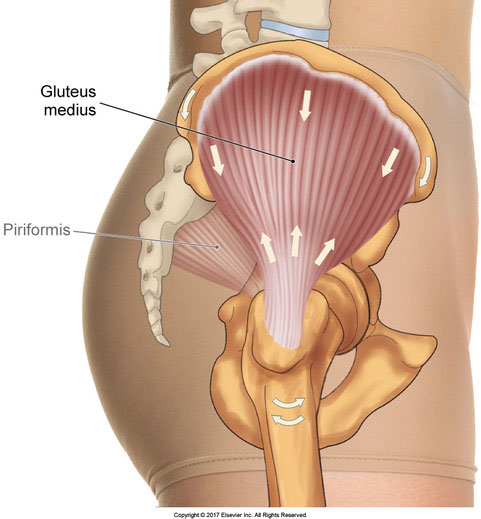 Gluteal Tendinopathy