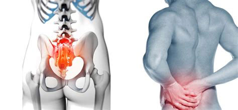 Pelvic pain used to be considered an extension of low back pain