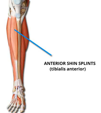 Anterior Shin Splints (Tibialis Anterior)
