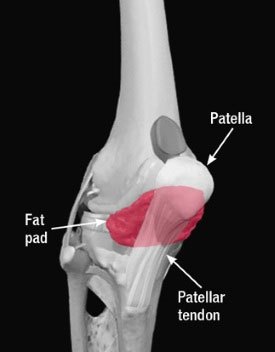 Diagram of the fat pad in the knee