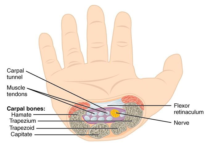 Carpal tunnel syndrome occurs when the median nerve becomes compressed.