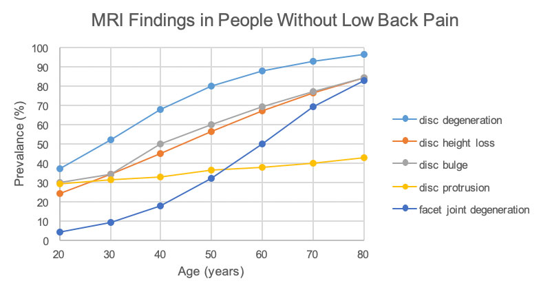 Abnormal MRI findings are found in many people with absolutely no lumbar spine pain