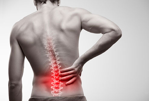 Disc-related low back pain can arise as either a sharp sudden onset of pain usually during a flexion-related activity, or as a gradual slow build up without any obvious injury. 