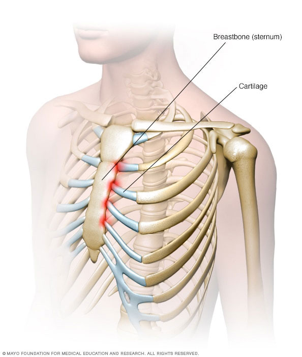 Diagram showing bone and cartilate interface