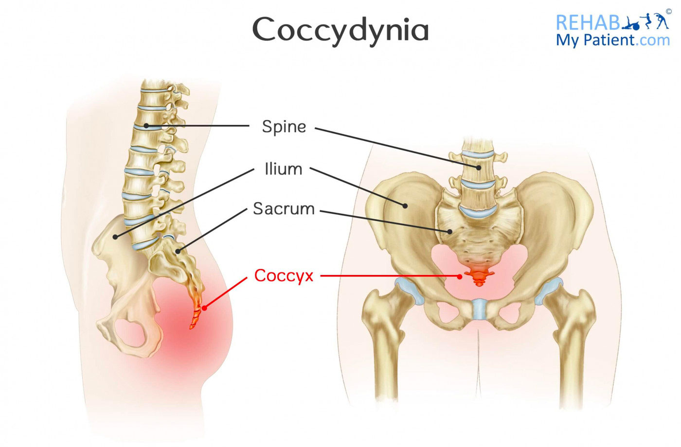 Diagram showing coccydnia