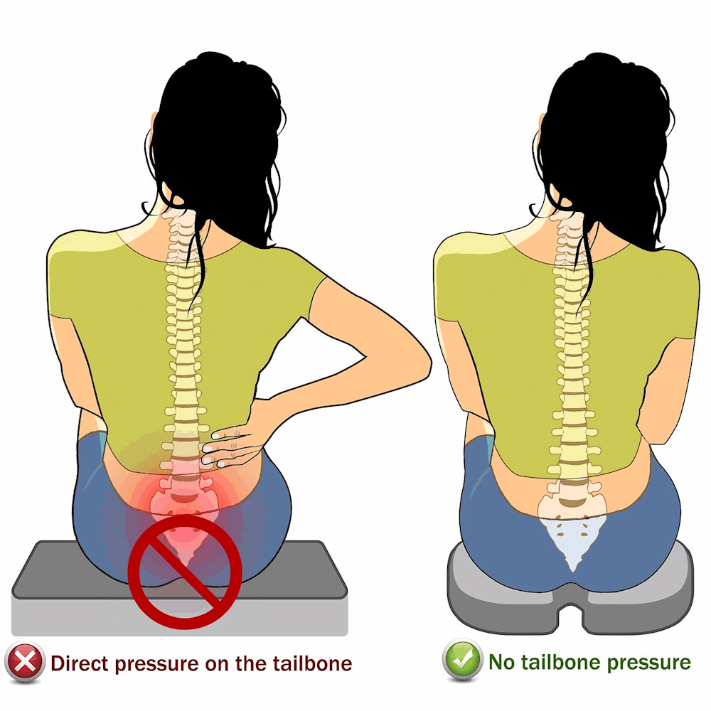 Ergonomic modifications can help relieve tailbone pain