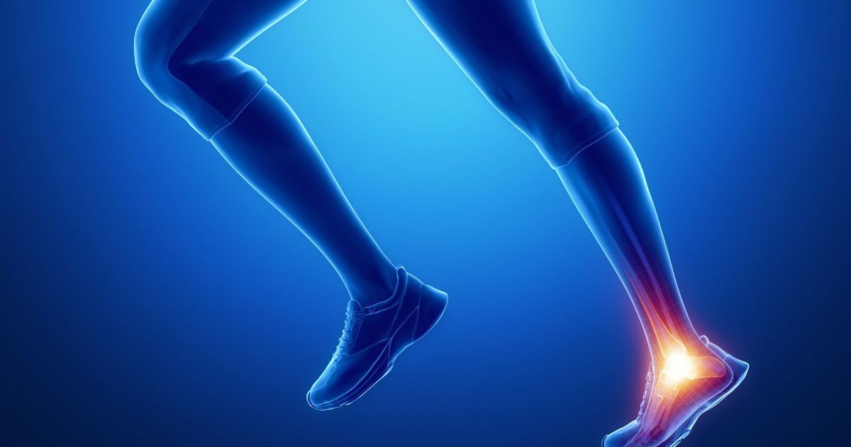 Achilles Tendinopathy