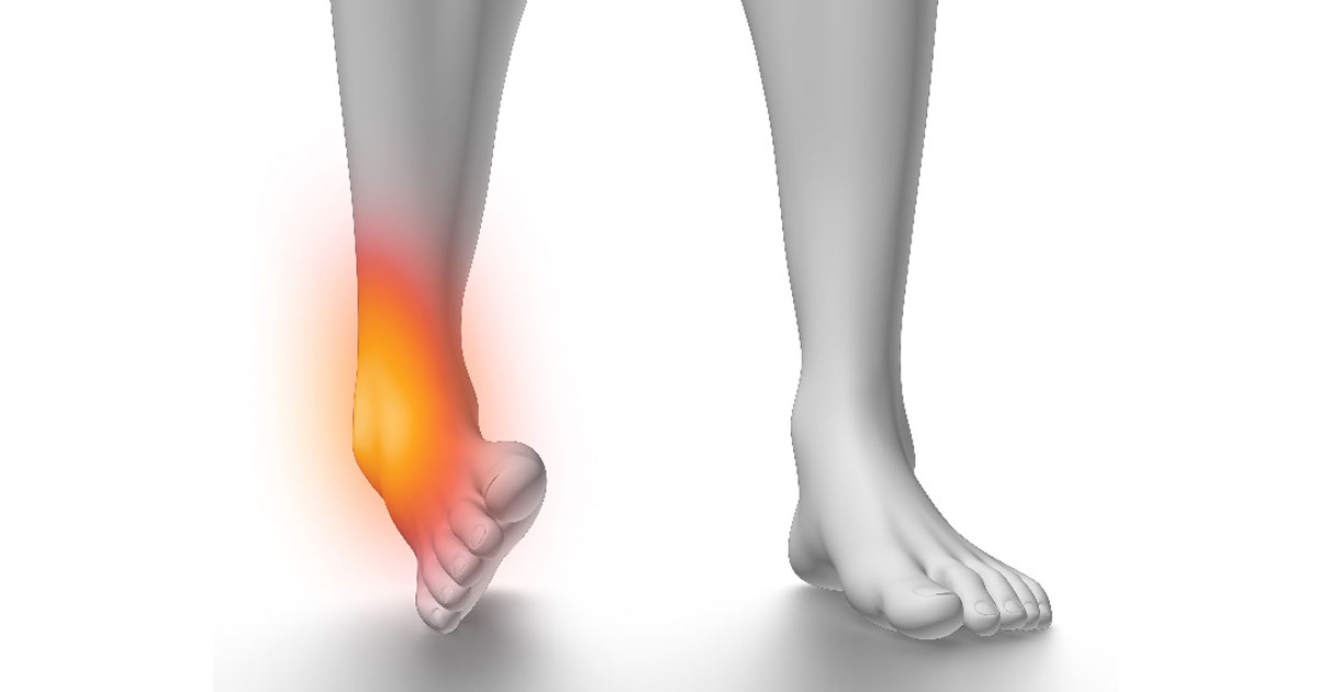 Should you get your ankle checked?