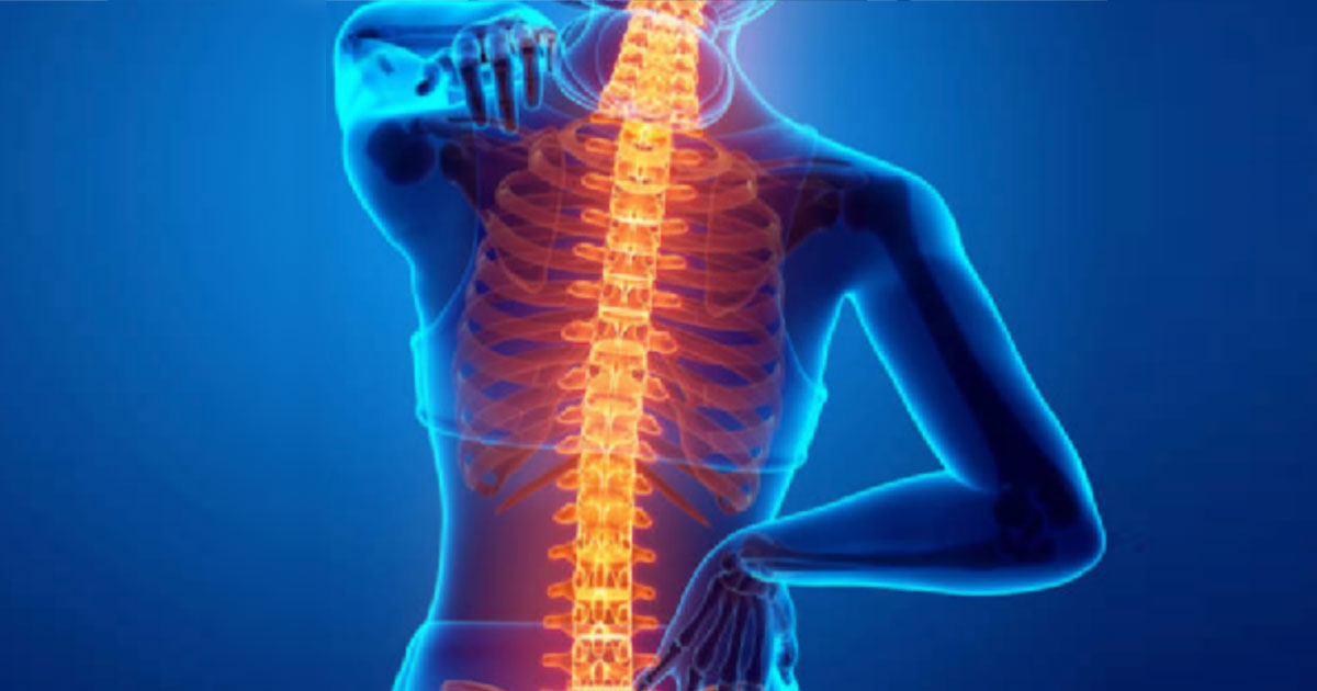 Ankylosing spondylitis (AS) is an autoimmune inflammatory arthritis that primarily affects the spine. In this condition the joints of the neck, back and pelvis become inflamed, which results in pain and stiffness. 