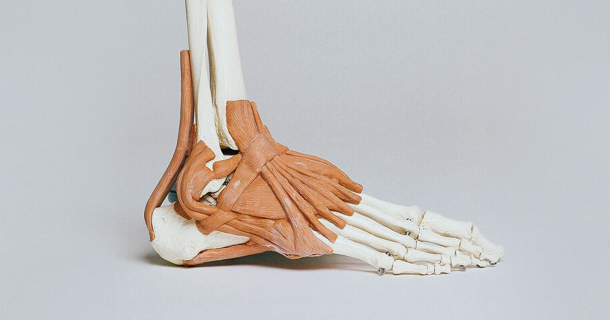 Navicular stress fractures are the most common bone to get a stress fracture. The condition tends to affect young active males that have had high levels of continued load going through there midfoot 